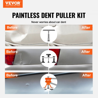 010929377183 - 69-Piece Lightweight Dent Repair Kit for Cars and Appliances